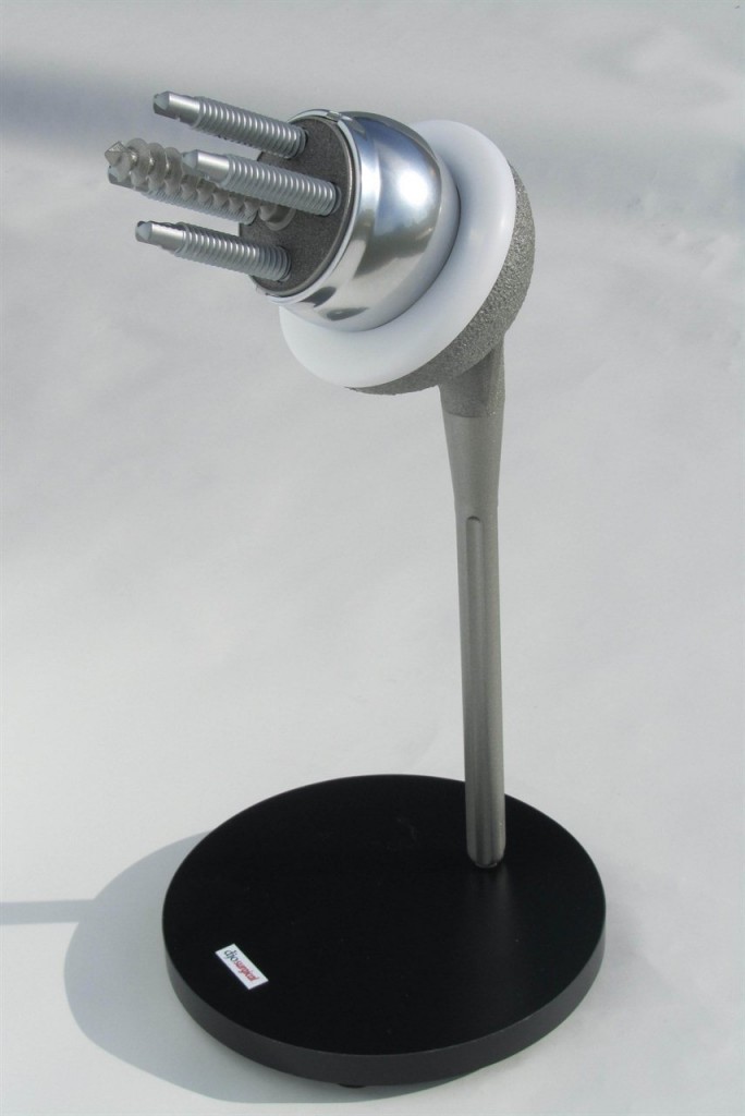 Shoulder Implant Model