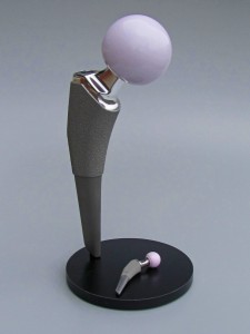 Hip Implant Model