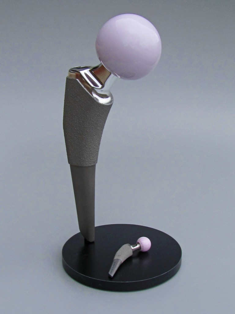 Hip Implant Model