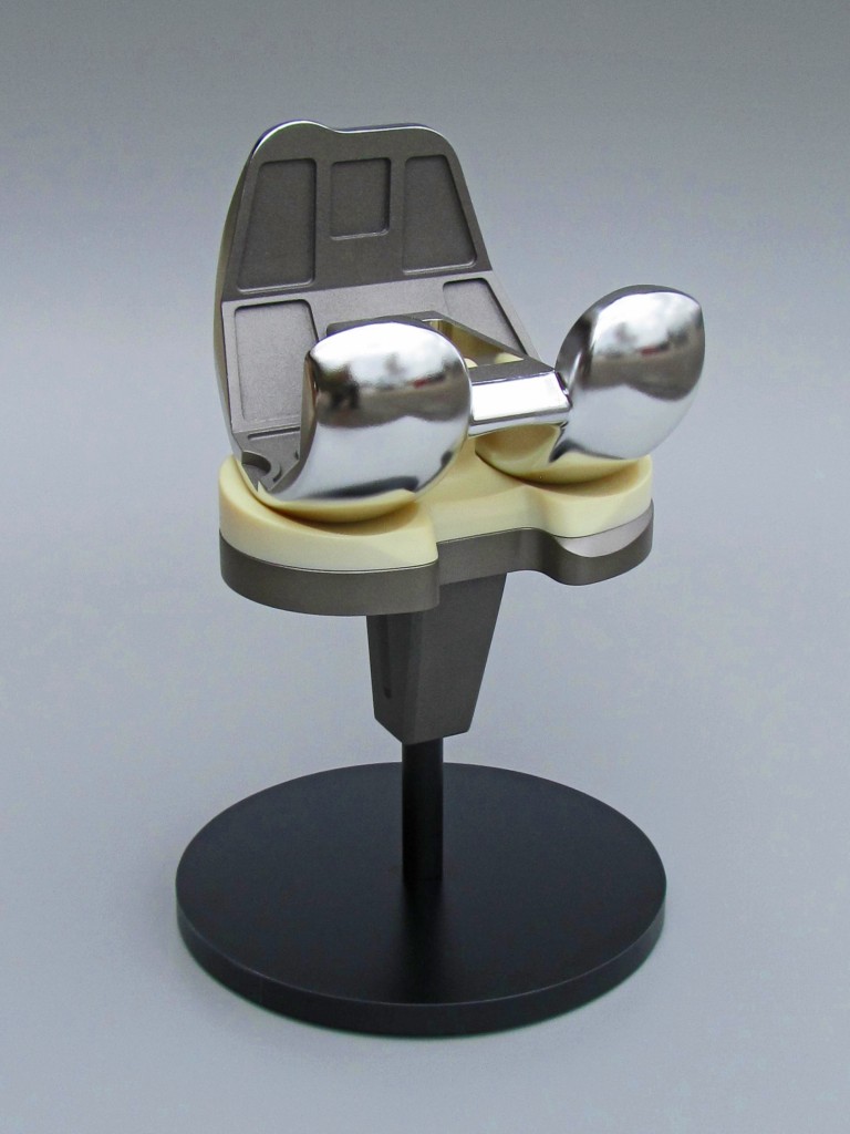 Knee Implant Model