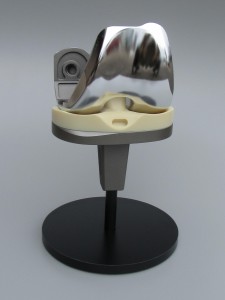 Knee Implant Model